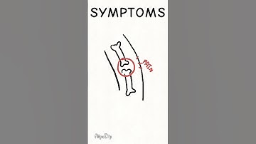 Hepatitis B Awareness #animation