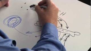What is Hyperparathyroidism? The Basic Video.