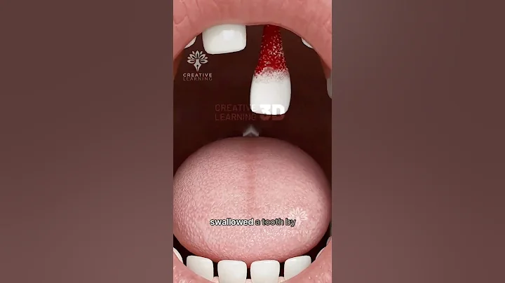 What Happens If You Swallow a Tooth 🦷 #short #viralvideo - Creativelearning3d
