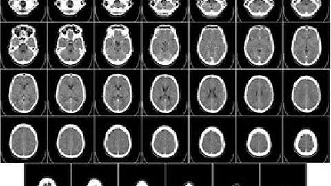 CT Brain filming #toshiba