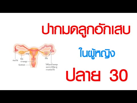 พบหมอเสรี ตอนที่ 669 : ปากมดลูกอักเสบในสาวๆปลาย 30