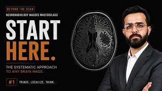Stop Guessing Brain Tumors: A Systematic Approach to Any Brain Mass | Neuroradiology masses #001