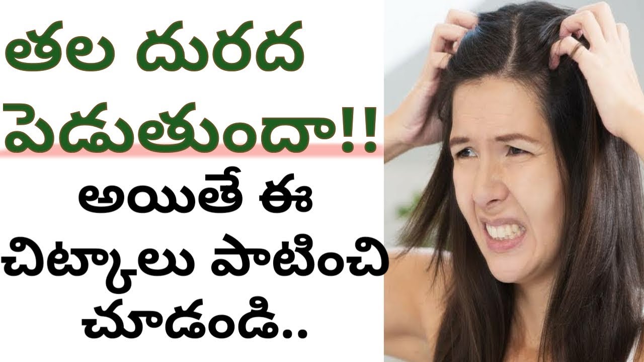 Scalp itching tips in telugu l scalp itching remedies in telugu l home