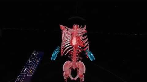 Augmented Reality Simulation at Scientific Sessions 2018 - Immersive Touch