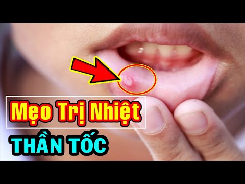 Mẹo Trị Nhiệt Miệng THẦN TỐC Khỏi Ngay Tức Khắc Không Cần Thuốc