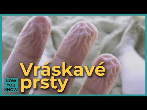 Video: Prečo Prsty Snívajú