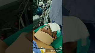 Awake Fibreoptic Intubation