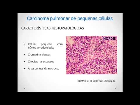 Vídeo: A Depleção Da Histona Metiltransferase KMT9 Inibe A Proliferação Celular De Câncer De Pulmão, Induzindo A Morte Celular Não Apoptótica