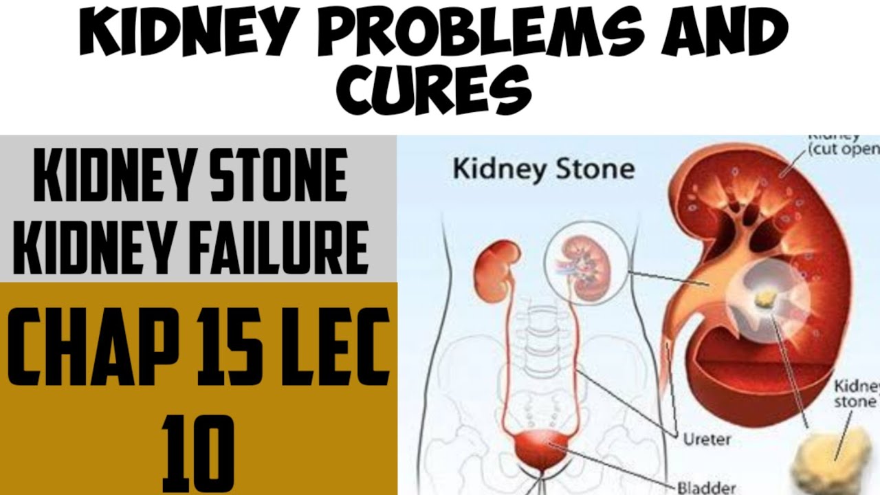 kidney problems and Cures Kidney stone and Renal Failure Biology
