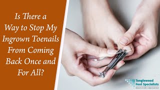 Is There a Way to Stop My Ingrown Toenails From Coming Back Once and For All? Stop Recurring Ingrown Toenails With A Permanent Treatment