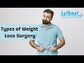Types of weight loss surgery  lyfboat