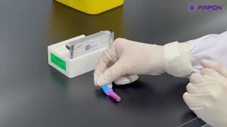 Fully automatic molecular diagnostic system sample pretreatment and loading