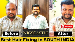 Best Hair Fixing in SOUTH INDIA | Call or Whatsapp 9577295779, 9739889849 | Wigs Castle