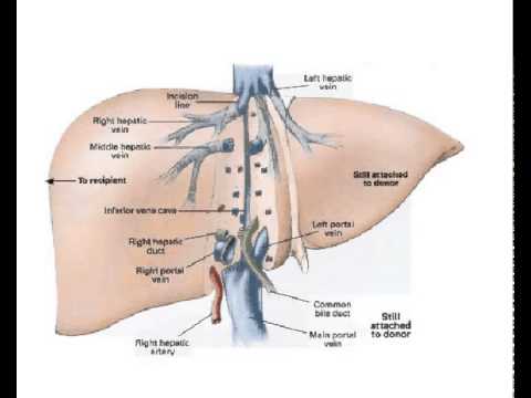 تأثير المخدرات علي الكبد
