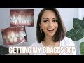 GETTING MY BRACES OFF FINALLY!