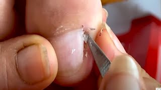 How to Repair Nails easy #372 - Xuyen Nail