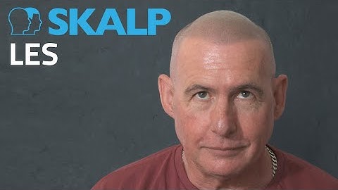 Hair loss solution!  Les