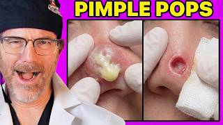 Plastic Surgeon Reacts to the Satisfying Pimple Popping!