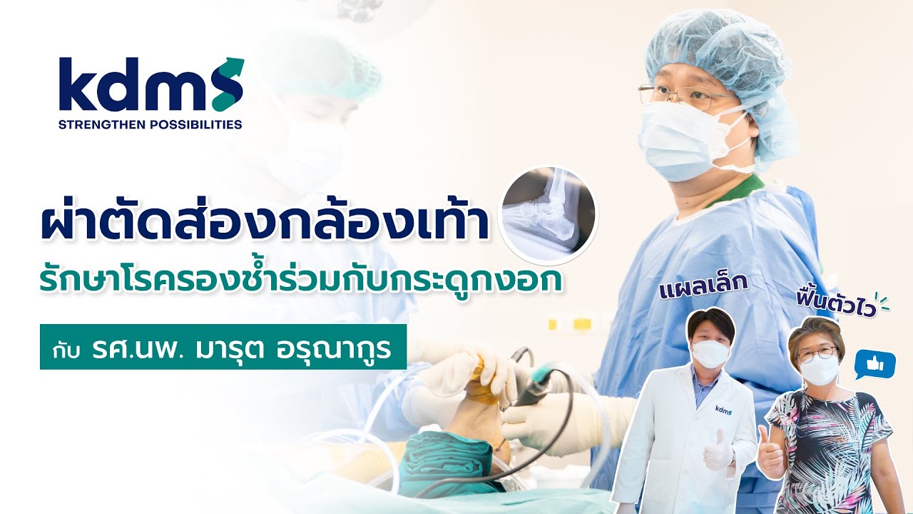 รักษาโรครองช้ำร่วมกับกระดูกงอกที่ส้นเท้า ด้วยวิธีการผ่าตัดส่องกล้อง l รศ.นพ.มารุต l ข้อดีมีสุข kdms