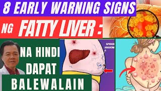 8 Early Warning Signs ng Fatty Liver Na Hindi Dapat Balewalain. - By Doc Willie Ong