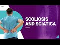Scoliosis And Sciatica