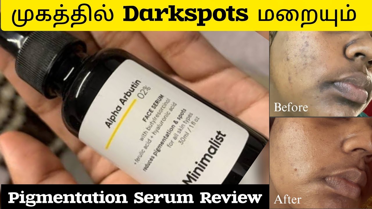 Minimalist Alpha Arbutin 2% Serum Review in tamil | Best Serum for Pigmentation, Acne & Dark Spots?