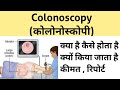 Colonoscopy test in Hindi | कोलोनोस्कोपी टेस्ट क्या है | कैसे होता है |