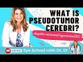 Pseudotumor Cerebri (IIH) Story Time | Eye Doctor Explains