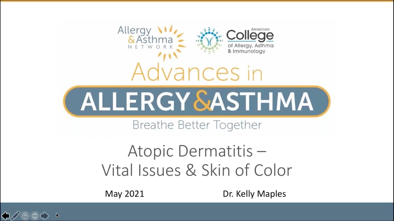 Atopic Dermatitis – Vital Issues & Skin of Color