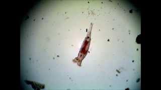 Bdelloid Rotifers 40X Objective