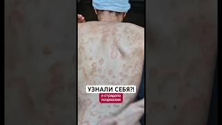Заказать Псорифенак можно на Wildberries. Артикул - 430728516