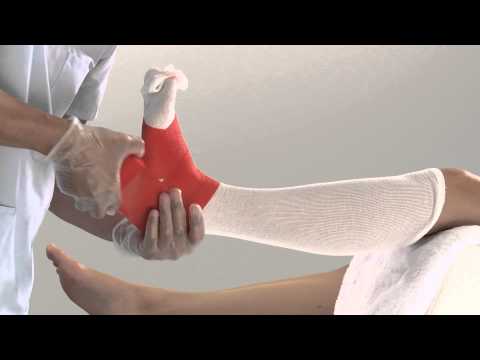 Delta-Cast Soft Lower Leg Cast Application