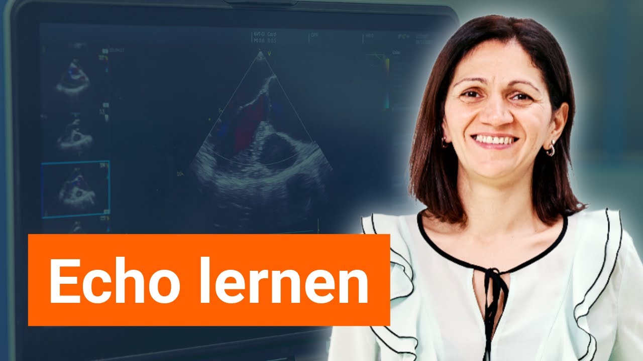 Echo lernen mit Struktur und System in jedem Bereich - YouTube
