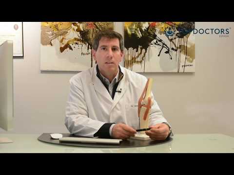 Rotura de menisco: diagnóstico y tratamiento