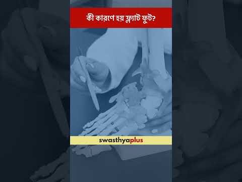 কী কারণে হয় ফ্ল্যাট ফুট? | What are the causes of Flat Feet? | Dr Sondipon Biswas | #Shorts