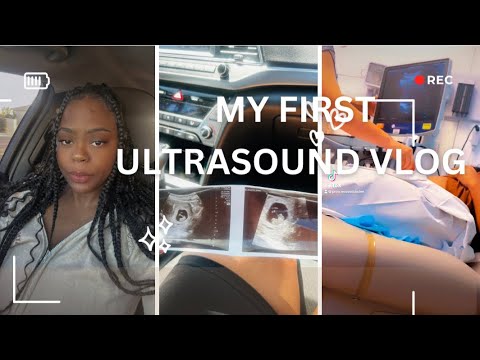 My first Ultrasound @ 9 weeks Vlog !! #earlypregancy - YouTube