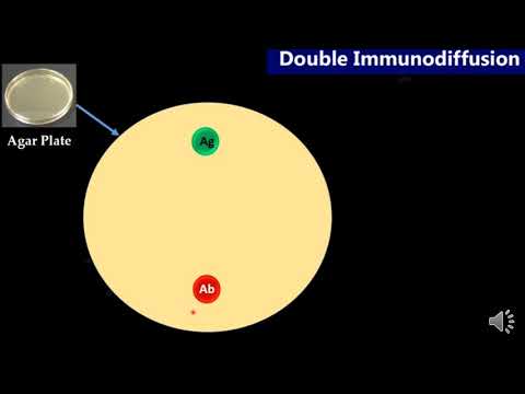 Vídeo: Prueba De Inmunoelectroforesis En Suero: Lo Que Necesita Saber