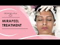 Derma puritys  mirapeel treatment