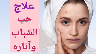 التخلص من حب الشباب وآثاره بوصفة متكاملة قوية وفعالة traitement acné naturel et efficace