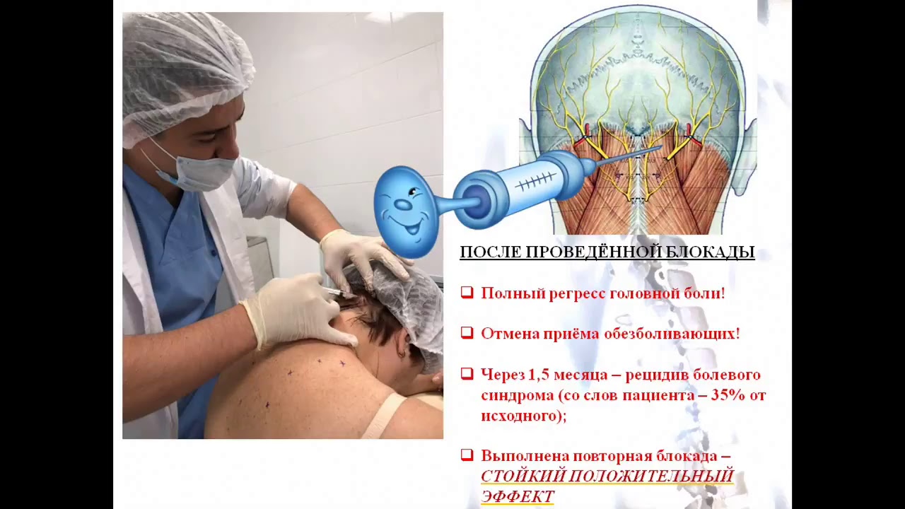 Конференция Болевой синдром на стыке специальностей ч1