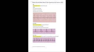 Dysrhythmia Basic B Test; Relias Dysrhythmia Basic B Test Questions and Answers 2023