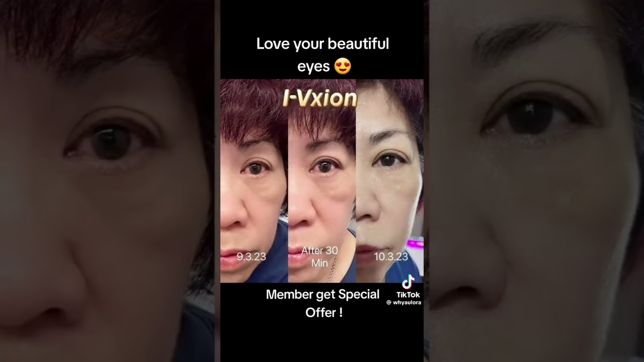 IVXION Vitamin for Eyes