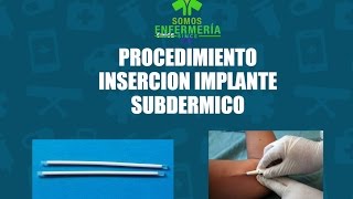 Procedimiento Insercion de implante subdermico (Jadell)
