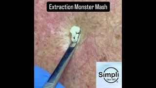 Extraction Monster Mash