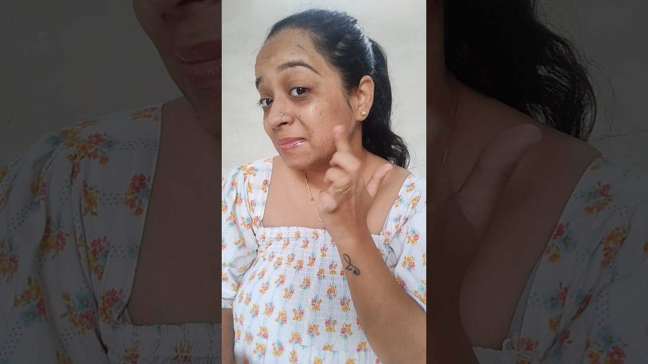 INSTANT DEAD SKIN & TAN REMOVAL 😯 | Sanfee instant dead skin removal gel review 