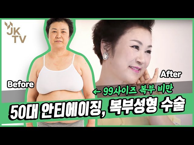 🔥복부비만🔥 50대도 복부지방흡입을 할 수 있나요 👀❔❕