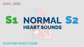 S1, S2 and splitting of S2 - Normal Heart Sounds