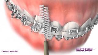 Edge Animations Proxy Brush (Audio) Edge Animations Normal Occlusion Audio