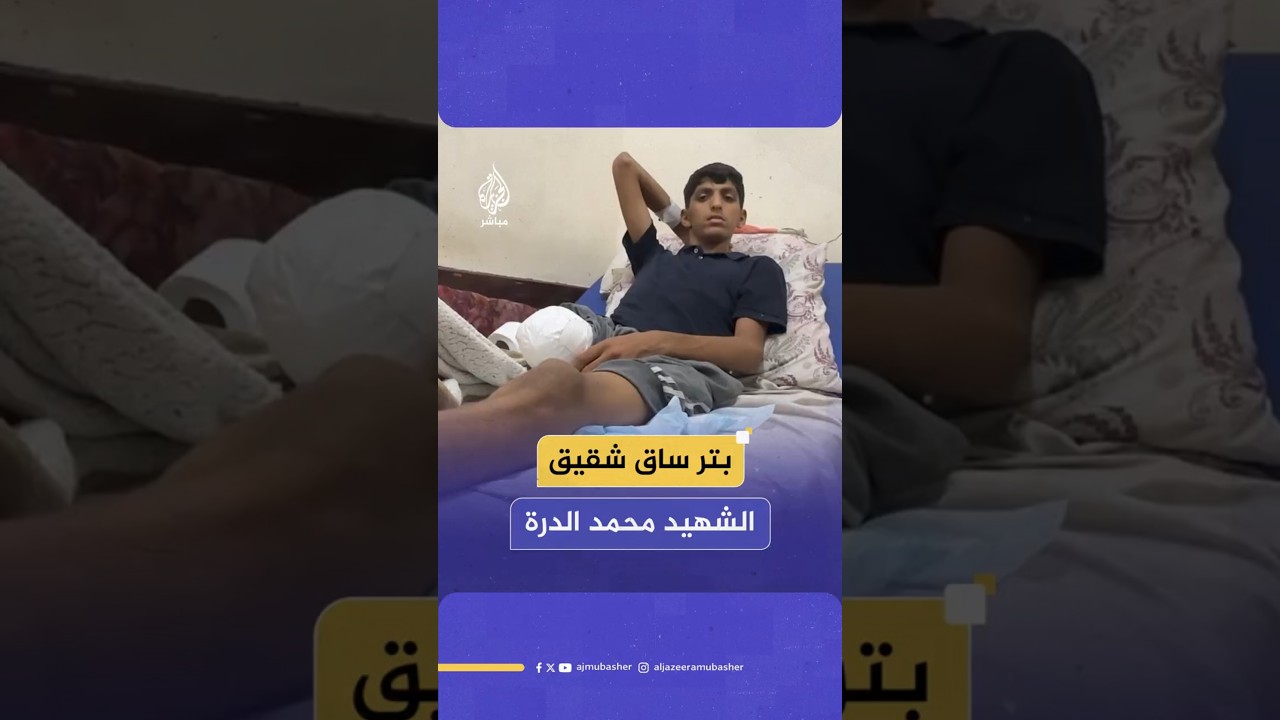 بتر ساق شقيق الشهيد محمد الدرة