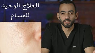 العلاج الوحيد للمسام الواسعة